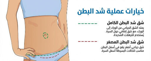 ندبة شق عملية شد البطن