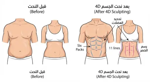 رسم توضيحي لتقنية نحت الجسم رباعي الأبعاد (4D Sculpting) يظهر كيفية إبراز عضلات البطن ورسم الخصر بدقة